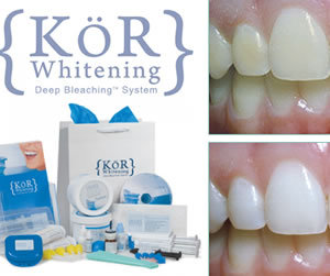 Link to more info about Kor Teeth Whitening