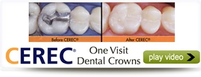 cerec