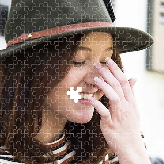 Congenitally Missing Teeth