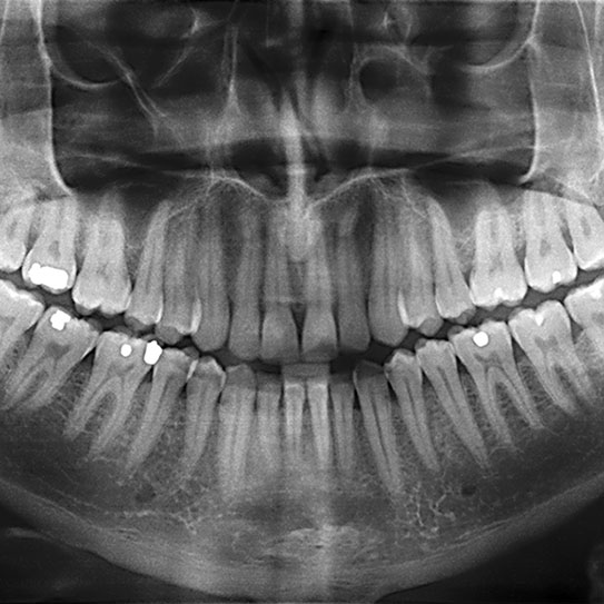 Dental X-Rays: It’s Time For Your Close-Up