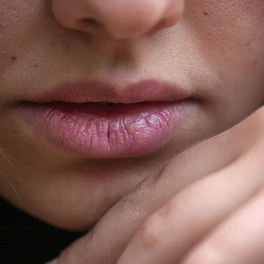Temporomandibular Disorders