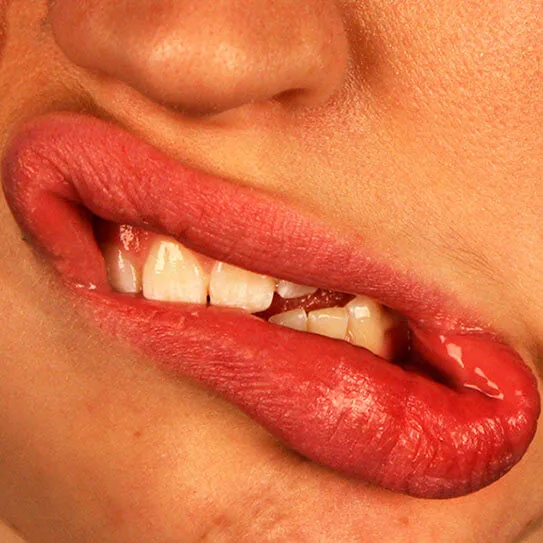 BLEEDING GUMS: CAUSES AND TREATMENT