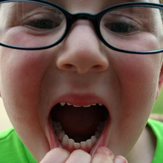 LOOSE TOOTH GAME PLAN