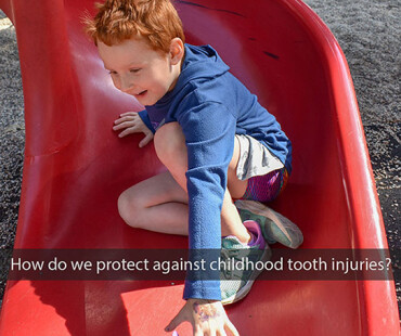 childhood-tooth-injuries-2022_543
