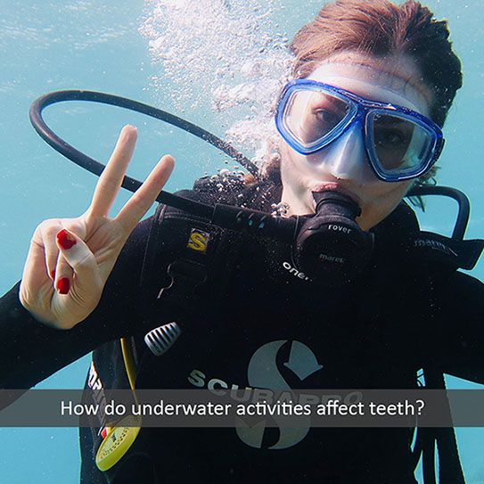 How Do Swimming and Diving Affect Teeth?